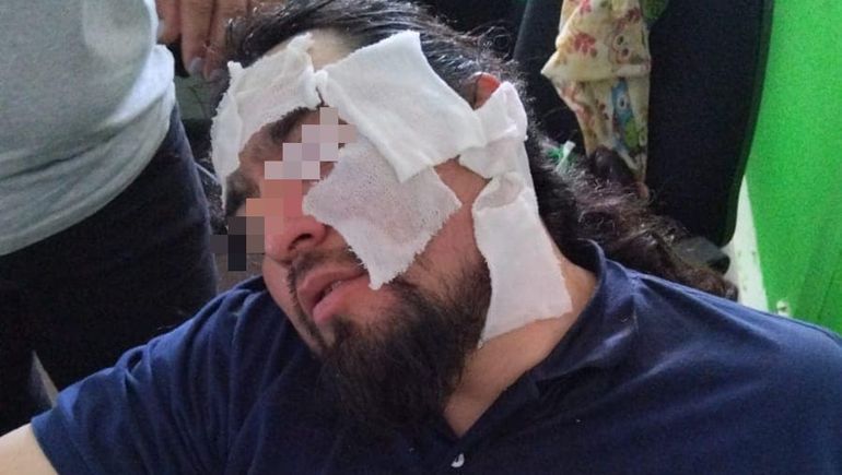 Otro incidente entre facciones de ATE: esta vez fue con gas pimienta
