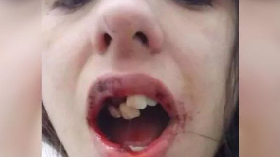 Con la boca destrozada