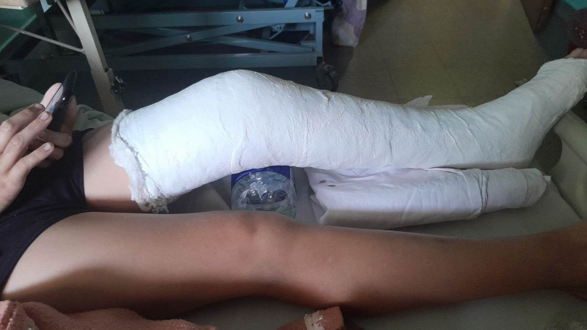 Indignante: Atropelló a menor y lo dejó tirado en el Hospital