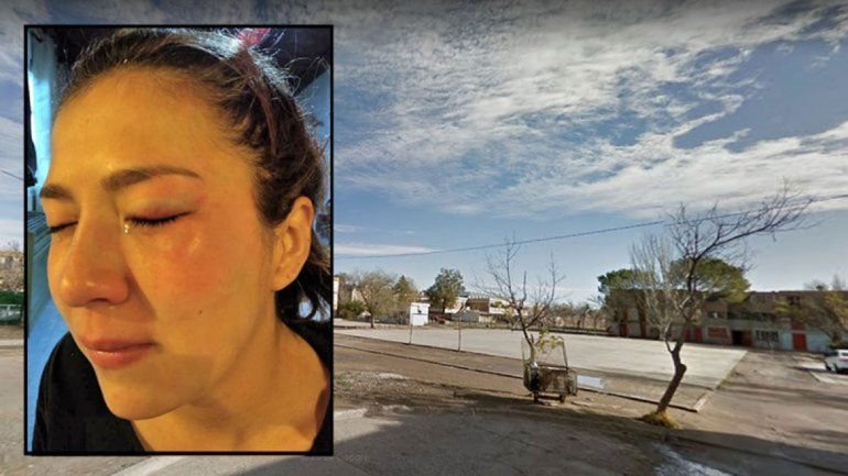 La adolescente de 17 años fue atacada en un playón de las 400 Viviendas.