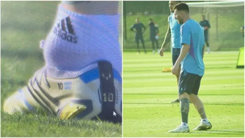 Una pelota de tenis: Preocupante imagen del tobillo de Messi