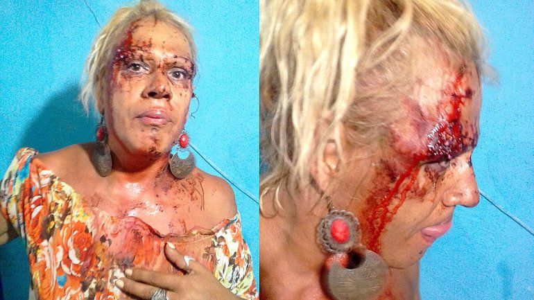 Guerra sin control por la prostitución en la Ruta 22: ahora la ligó Mamucha Ramírez