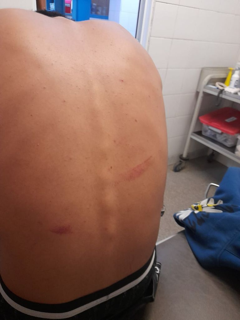 Denuncian brutal golpiza policial a jóvenes en Junín de los Andes