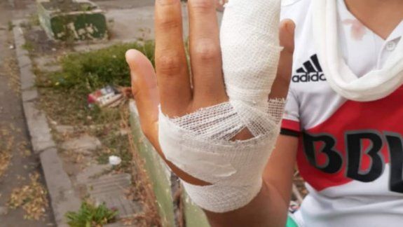 Fernando perdió parte de su dedo.&nbsp;