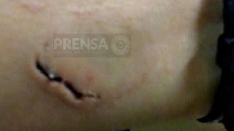 El policía sufrió una profunda herida en un brazo producto de la mordida.