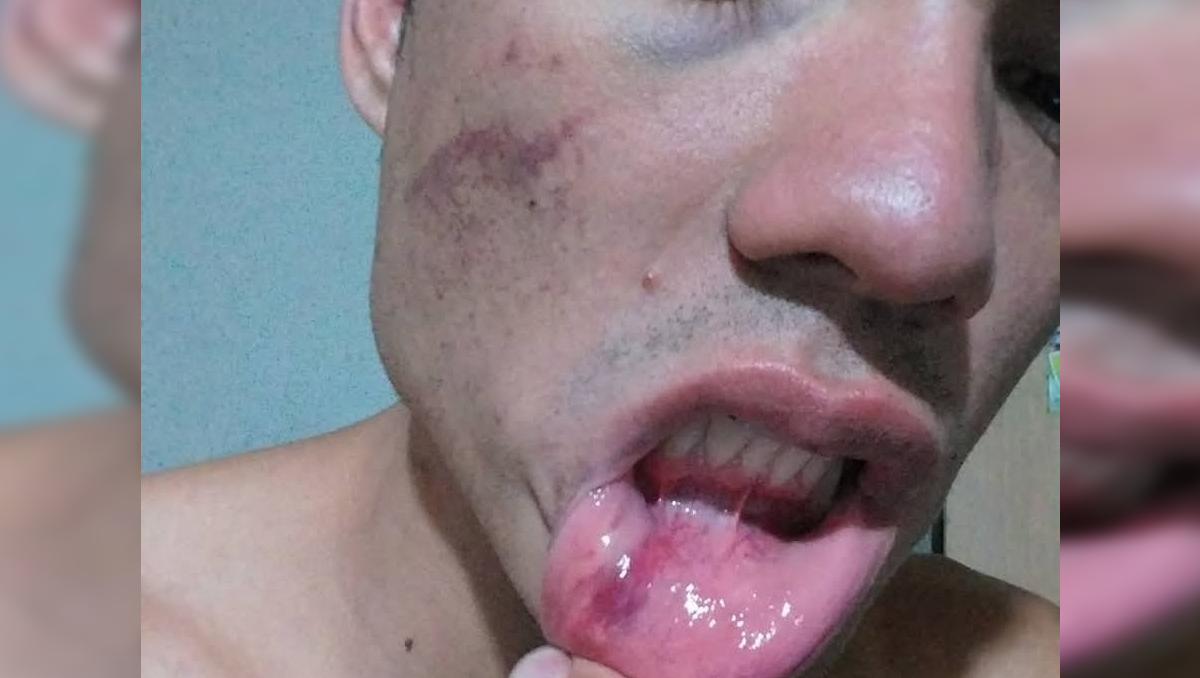 El joven de 24 años asegura que lo golpearon en el piso y le tiraron gas pimienta.