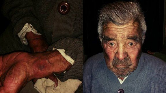 Le dieron una brutal golpiza a un abuelo y lo dejan atado 12 horas