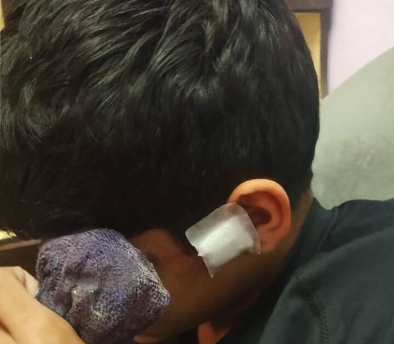 Uno de los menores agredidos, según la denuncia, por personal del Circo. Uno de los menores agredidos, según la denuncia, por personal del Circo.