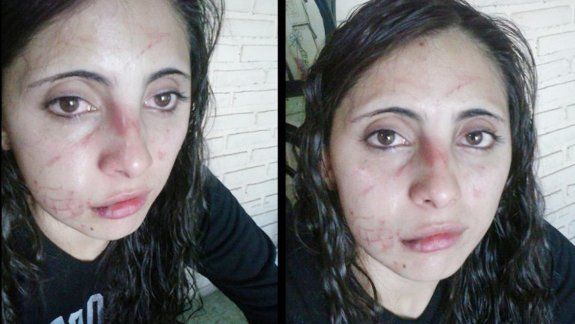 Fabiana, de 27 años, sufrió una brutal agresión por parte de un grupo de mujeres y decidió denunciar el hecho a través de las redes sociales.