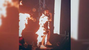 La impactante foto de Duki en llamas: ¿real o fake?