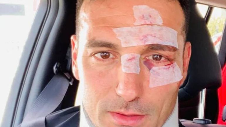 Los mejores memes de los incidentes entre Argentina y Brasil