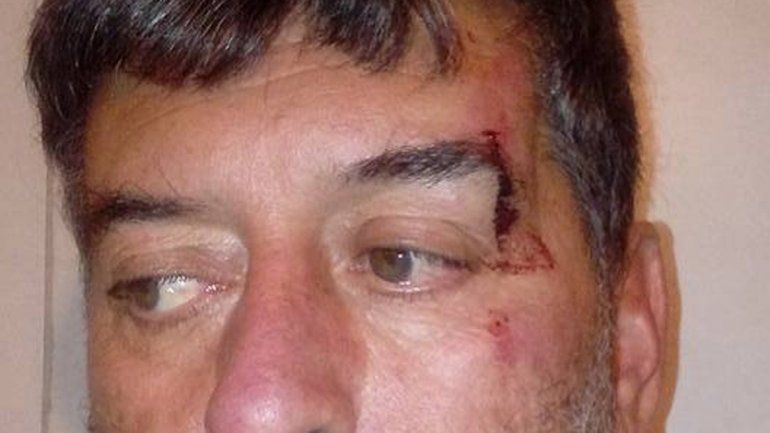José Martínez sufrió un corte sobre un ojo tras forcejear con un ladrón.