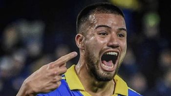 Revuelo y memes en las redes por el retoque de labios del Chelo Weigandt | LMCipolletti.com Revuelo y memes en las redes por el retoque de labios del Chelo Weigandt