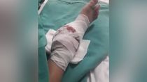 una nena resulto herida cuando se le cayo encima la hamaca de una plaza