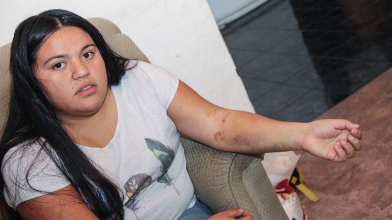 Candelaria fue brutalmente atacada por cuatro perros en el barrio Labraña