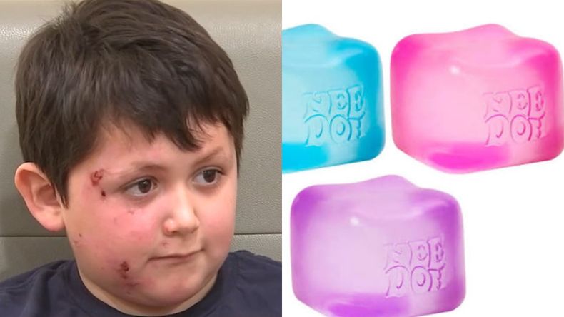 Intentó hacer un reto viral en las redes sociales y sufrió graves quemaduras | LMCipolletti.com Intentó hacer un reto viral en las redes sociales y sufrió graves quemaduras