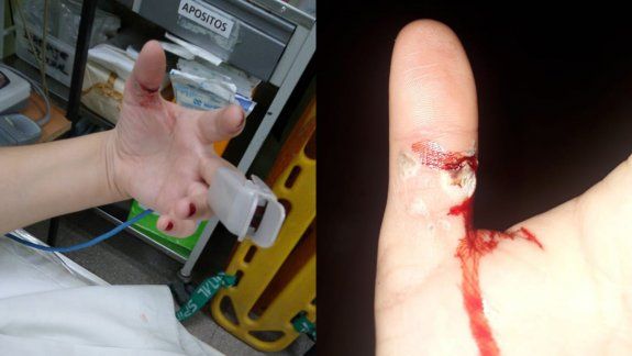 Joven se electrocutó y su madre agradeció la atención