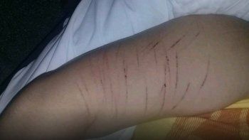 las grutas: le entraron a robar a su casa y le dieron brutal golpiza