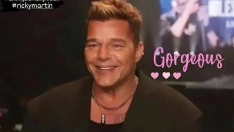 Ricky Martin explicó qué le pasó en la cara