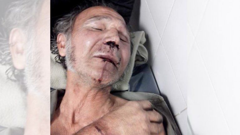 Así quedó el rostro del abuelo golpeado.