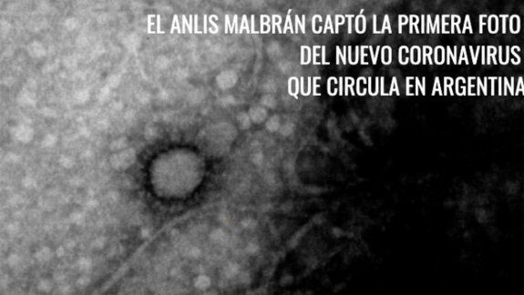 El Instituto Malbrán logró fotografiar la cepa del coronavirus argentino
