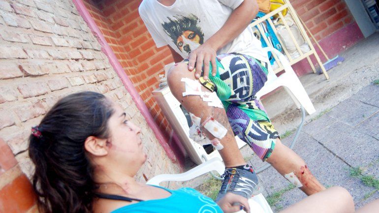 En el rostro de Yarella y la pierna de Luis quedaron las huellas del ataque.