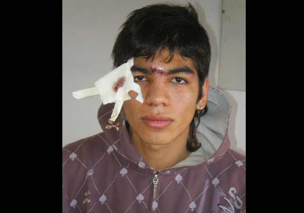 Joven denunció que la Policía lo golpeó