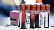 se detectan mas de 30 casos de cancer de la sangre por dia en la argentina