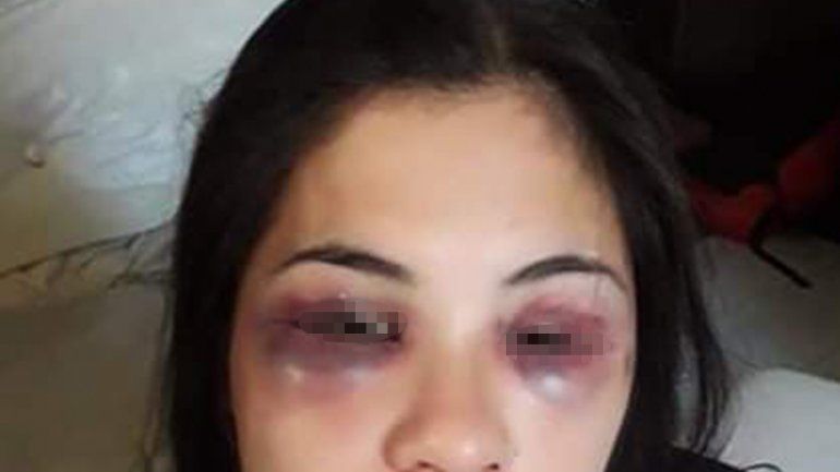 Tras los festejos por Año Nuevo, le desfiguró la cara y hasta la cortó con un vidrio
