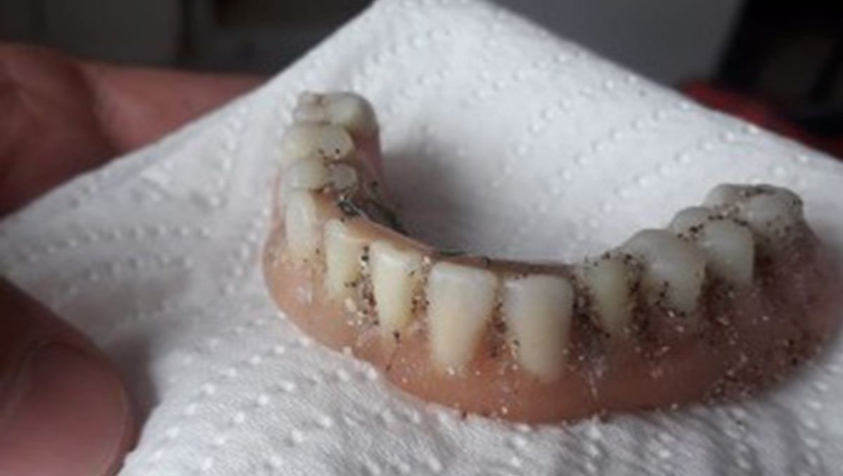 Encontró una dentadura en la playa y movilizó las redes para hallar al dueño
