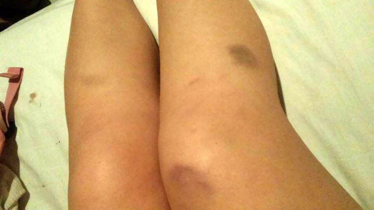 Denuncian que una patovica agredió a una adolescente en un boliche cipoleño