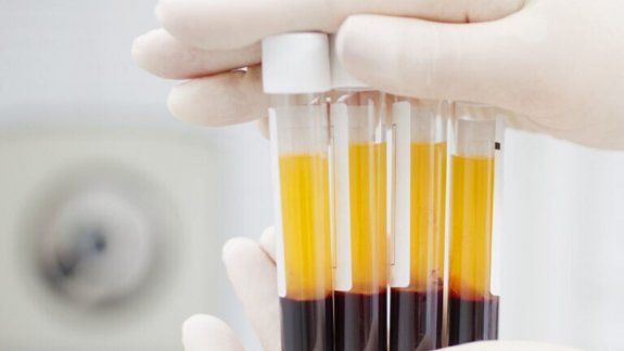 Río Negro avanza con los protocolos de donación de plasma