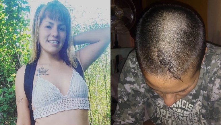 Le rompieron la cabeza de un piedrazo, estuvo en coma y vive para contarlo