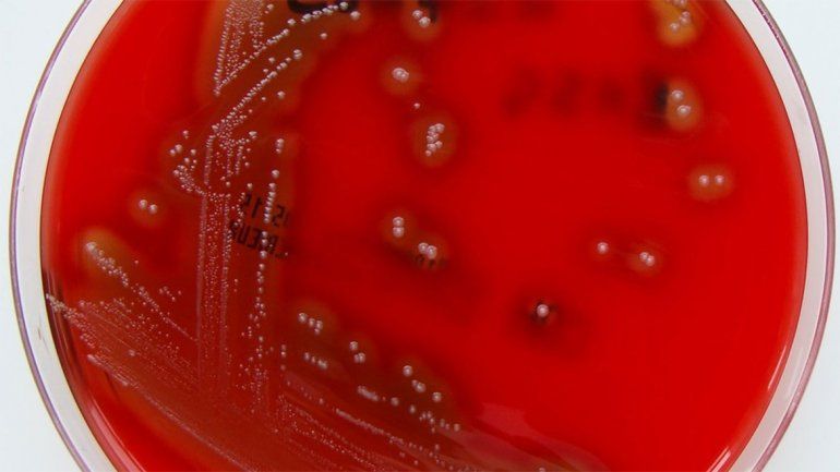 Ya son los cuatro los niños que murieron a causa de una bacteria