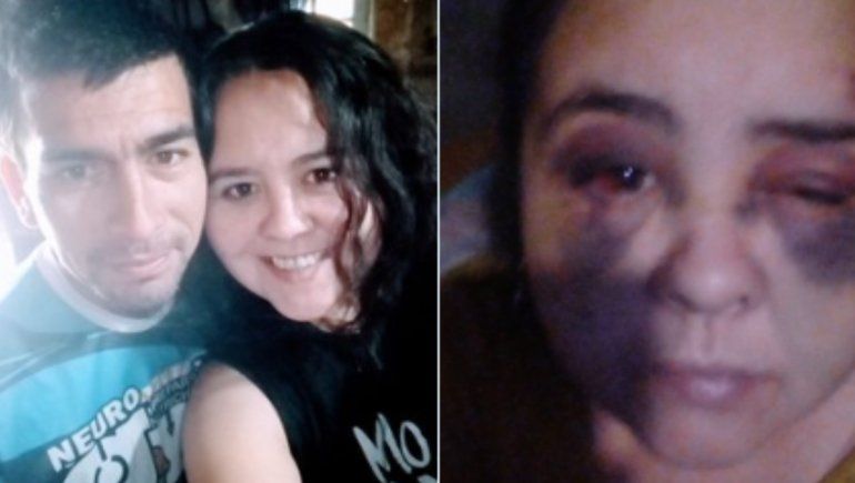 La joven neuquina reside en Chos Malal. Viralizó su foto para terminar con su calvario. 