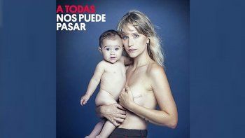 impactante foto de brenda gandini para concientizar sobre el cancer 