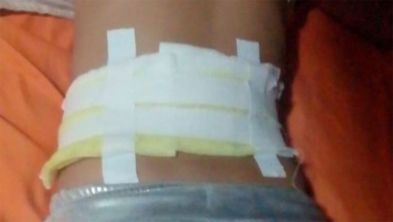 Allen: perros sueltos atacaron a una niña