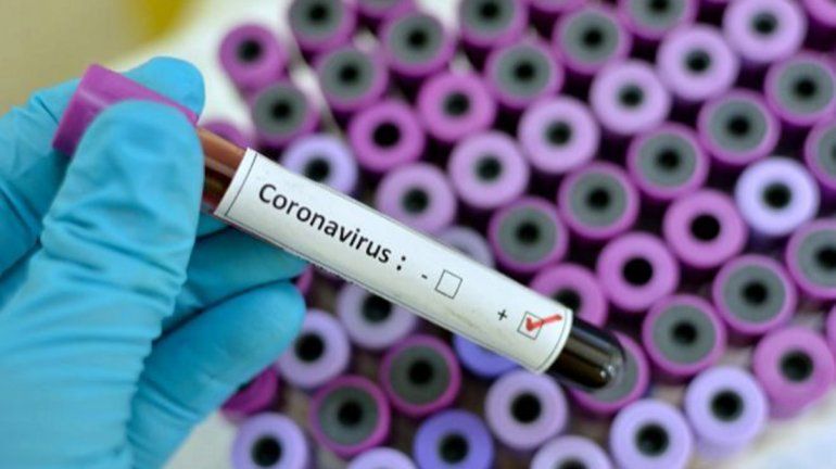 Murió un paciente de Allen por coronavirus