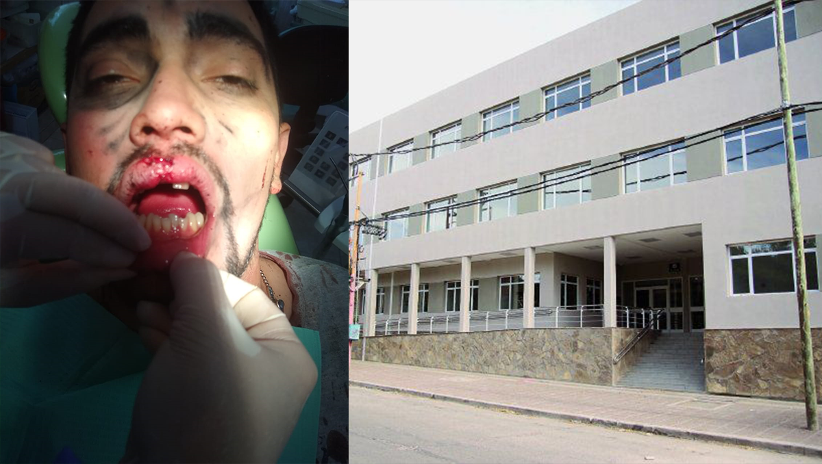 Brutal golpiza : Fui a buscar mi campera y me desfiguró
