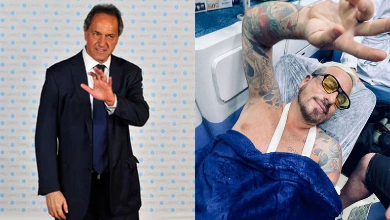 El chiste de Daniel Scioli a Fede Bal, luego del terrible accidente del actor