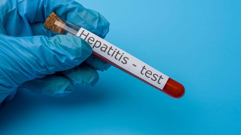 Detectan el primer caso de hepatitis aguda infantil en Argentina