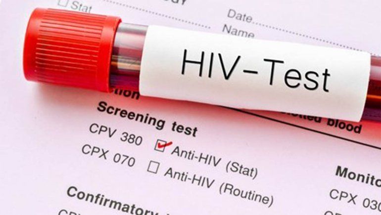 Una mujer argentina se habría curado de VIH por inmunidad natural