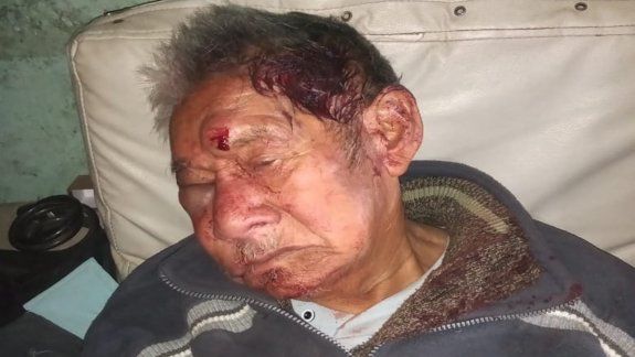 Se agrava la salud del abuelo atacado por delincuentes