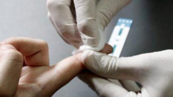 Harán testeos de VIH y Sífilis en la facultad