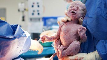 pesquisa neonatal: promueven la inclusion de la atrofia muscular espinal en el programa nacional