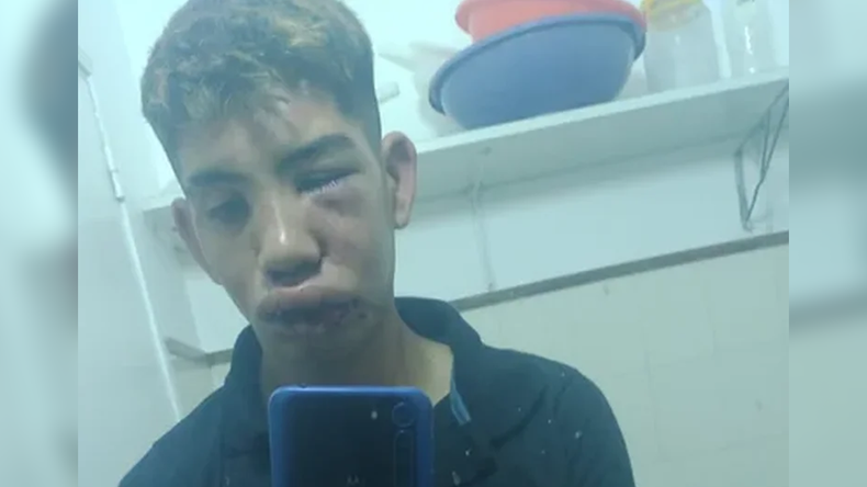 Salvaje golpiza a un joven tras un discusión de tránsito
