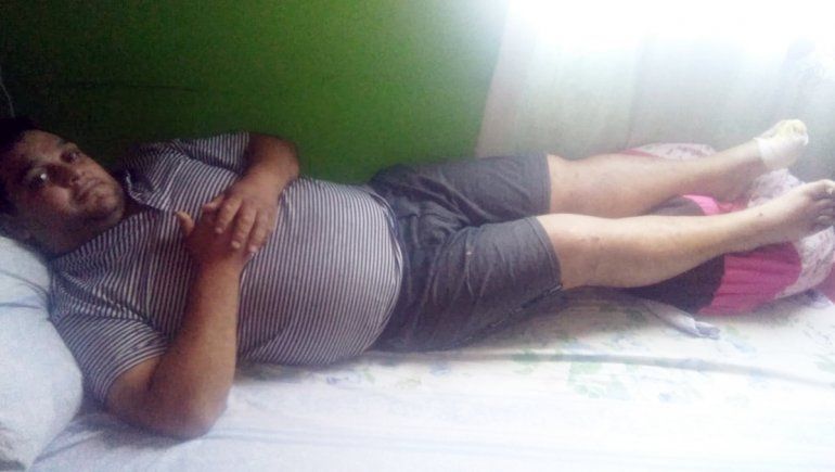 Lo aplastó el camión recolector de basura y se salvó de milagro 