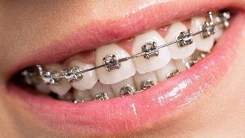 prohiben la venta de productos para tratamientos de ortodoncia