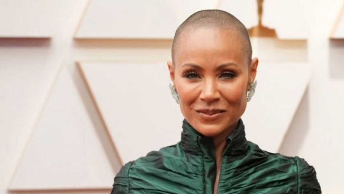 ¿Qué es la alopecia?: la enfermedad que desató el escándalo en los Oscar