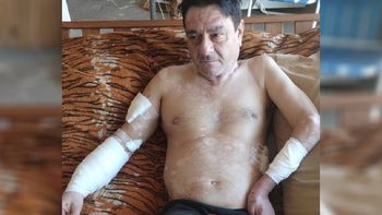 Luis García, el vecino del barrio Martín Fierro. Sufrió serias heridas por el ataque de cuatro perros. 